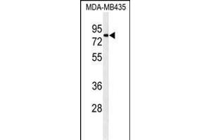 Western blot analysis of ATHL1 Antibody (C-term) (ABIN1881084 and ABIN2840111) in MDA-M cell line lysates (35 μg/lane).