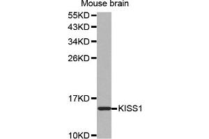 Western blot analysis of extracts of mouse brain, using KISS1 antibody (ABIN5971535). (KISS1 antibody)