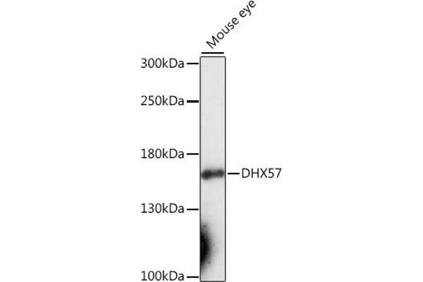 DHX57 Antikörper  (AA 700-900)