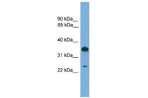TPD52 antibody used at 0. (TPD52 antibody  (C-Term))