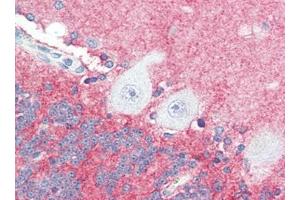 Human Brain, Cerebellum (formalin-fixed, paraffin-embedded) stained with SLITRK2at 5 µg/ml followed by biotinylated goat anti-rabbit IgG secondary antibody, alkaline phosphatase-streptavidin and chromogen. (SLITRK2 antibody  (C-Term))