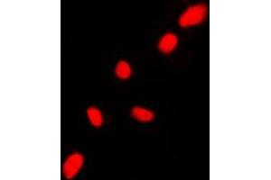 Immunofluorescence (IF) image for anti-Checkpoint Kinase 2 (CHEK2) (N-Term) antibody (ABIN7297888)