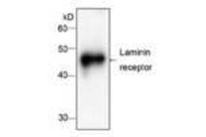 Image no. 1 for anti-Ribosomal Protein SA (RPSA) antibody (ABIN791537) (RPSA/Laminin Receptor antibody)