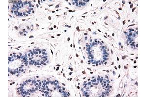 Immunohistochemical staining of paraffin-embedded breast tissue using anti-BRAF mouse monoclonal antibody. (BRAF antibody)