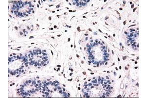 Immunohistochemical staining of paraffin-embedded breast tissue using anti-BRAF mouse monoclonal antibody.