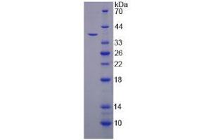Image no. 1 for Tripeptidyl Peptidase I (TPP1) (AA 1-320) protein (His tag) (ABIN6236919)