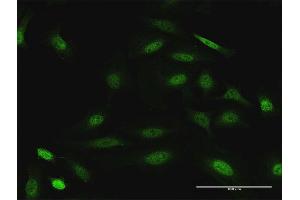 Immunofluorescence of purified MaxPab antibody to DUSP22 on HeLa cell.