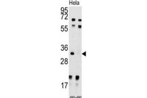 Western Blotting (WB) image for anti-Uridine-Cytidine Kinase 2 (UCK2) antibody (ABIN3003032)