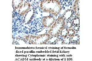 Image no. 1 for anti-Medium-Chain Specific Acyl-CoA Dehydrogenase, Mitochondrial (MCAD) antibody (ABIN791208) (Medium-Chain Specific Acyl-CoA Dehydrogenase, Mitochondrial (MCAD) antibody)