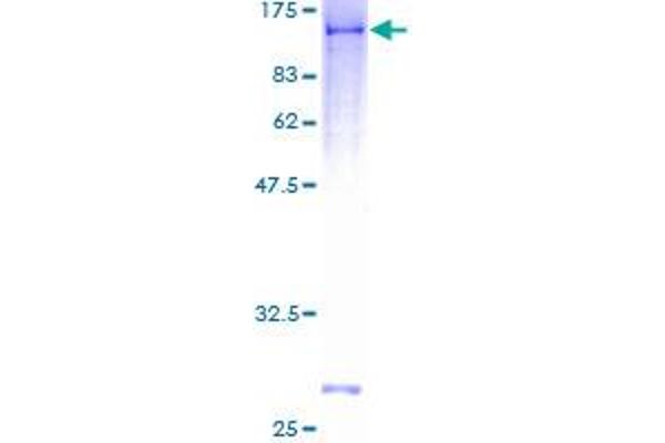 DDX1 Protein (AA 1-740) (GST tag)