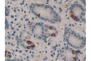 Immunohistochemistry (IHC) image for anti-Endonuclease VIII-Like 1 (NEIL1) (AA 43-314) antibody (ABIN7430099)