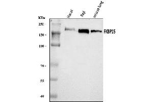 Western blot analysis of FKBP135/FKBP15 using anti-FKBP135/FKBP15 antibody (ABIN7600397). (FKBP15 antibody  (AA 19-1210))