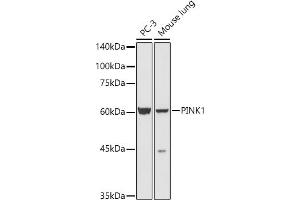 Western blot analysis of extracts of various cell lines, using PINK1 antibody (ABIN6128458, ABIN6145666, ABIN6145668 and ABIN6222945) at 1:500 dilution. (PINK1 antibody  (AA 282-581))