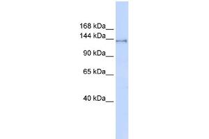 WB Suggested Anti-SUPT16H Antibody Titration:  0.