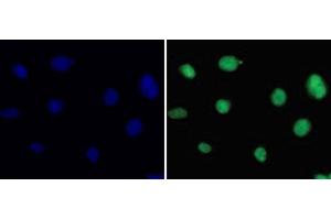 Immunofluorescence analysis of 293T cells using DiMethyl-Histone H3-K36 Polyclonal Antibody (Histone 3 antibody  (2meLys36))