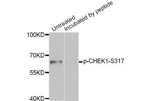 Western blot analysis of extracts of MCF7 cell line, using Phospho-CHEK1-S317 antibody (ABIN5969879). (CHEK1 antibody  (pSer317))
