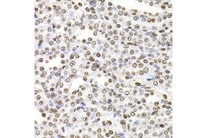 Immunohistochemistry of paraffin-embedded rat kidney using SOX5 antibody. (SOX5 antibody  (AA 1-120))