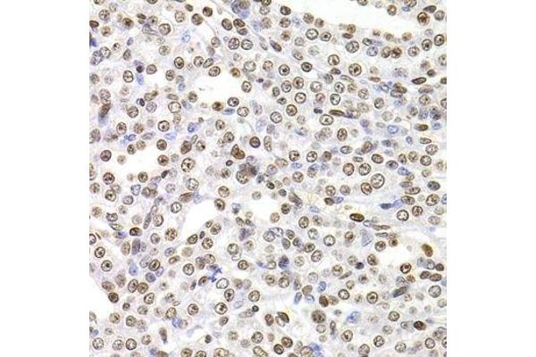 SOX5 antibody  (AA 1-120)