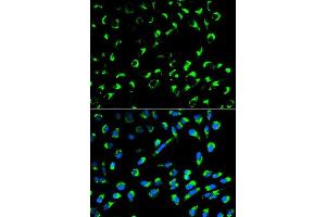 Immunofluorescence analysis of MCF-7 cells using SFN antibody. (14-3-3 sigma/SFN antibody  (AA 1-248))