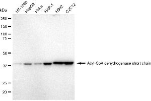 Western blotting analysis using Acyl-CoA dehydrogenase short chain antibody (ABIN7797493).