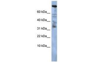 ZNF251 antibody  (AA 191-240)