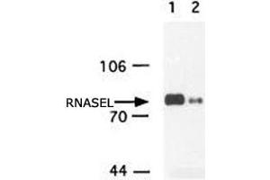 Western blot analysis of RNASEL in insect cell extracts transfected with recombinant human RNASEL using RNASEL monoclonal antibody, clone 2E9 . (RNASEL antibody)