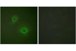 Immunofluorescence analysis of HuvEc cells, using EPHB1/2 (Ab-594/604) Antibody. (EPHB1/2 antibody  (AA 561-610))