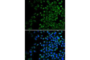 Immunofluorescence analysis of HeLa cells using BAK1 antibody. (BAK1 antibody)