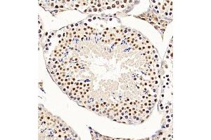 Immunohistochemistry of paraffin embedded mouse testis using CHD1L (ABIN7073491) at dilution of 1:650 (300x lens) (CHD1L antibody)