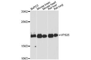 Western blot analysis of extracts of various cell lines, using VPS25 antibody. (VPS25 antibody)