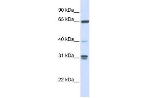 Western Blotting (WB) image for anti-Guanylate Binding Protein 2, Interferon-Inducible (GBP2) antibody (ABIN2459799) (GBP2 antibody)