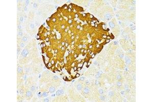 Immunohistochemistry of paraffin-embedded Mouse pancreatic islets using DDIT3 / CHOP Polyclonal Antibody at dilution of 1:100 (40x lens). (DDIT3 antibody)