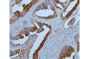 IHC analysis of PYROXD1 using anti-PYROXD1 antibody (ABIN6719650). (PYROXD1 antibody  (AA 48-230))