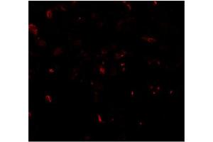 Immunofluorescence of TFEB in human lung tissue with TFEB antibody at 20 μg/mwith TFEB antibody at 2 µg/ml