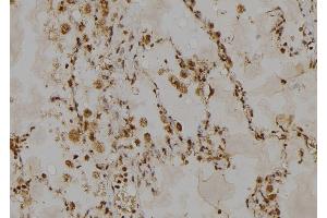 ABIN6268885 at 1/100 staining Human lung tissue by IHC-P. (HSPH1 antibody  (C-Term))