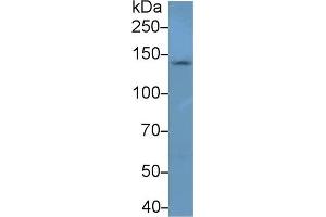 Detection of NEF3 in Mouse Cerebrum lysate using Polyclonal Antibody to Neurofilament 3 (NEF3) (NEFM antibody  (AA 105-287))