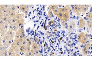 Detection of CASP1 in Human Liver Tissue using Polyclonal Antibody to Caspase 1 (CASP1) (Caspase 1 antibody  (AA 120-297))