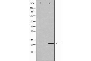 Western blot analysis of extracts of HepG2, using IFNB1 antibody.