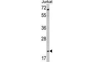 Western blot analysis of Glucagon Antibody (C-term) in Jurkat cell line lysates (35 µg/lane). (Glucagon antibody  (C-Term))