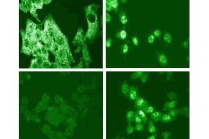 Immunofluorescence staining for p38 MAPK (pT180/pY182) (right figure). (MAPK14 antibody  (pThr180))