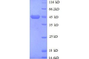 Insulin-Like Growth Factor 2 Receptor (IGF2R) (AA 2328-2491), (partial) protein (GST tag)