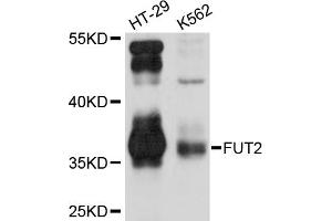 Western blot analysis of extracts of various cell lines, using FUT2 antibody. (FUT2 antibody)