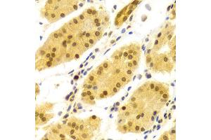 Immunohistochemistry (IHC) image for anti-ELAV (Embryonic Lethal, Abnormal Vision, Drosophila)-Like 1 (Hu Antigen R) (ELAVL1) (AA 1-326) antibody (ABIN3022231)