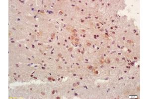 Formalin-fixed and paraffin embedded rat brain labeled with Anti-NDUFV1 Polyclonal Antibody, Unconjugated (ABIN751738) at 1:200 followed by conjugation to the secondary antibody and DAB staining