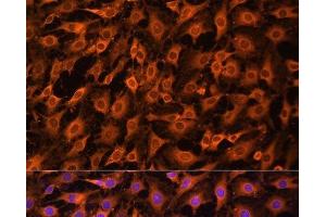 Immunofluorescence analysis of C6 cells using ERK1 / ERK2 Polyclonal Antibody at dilution of 1:100. (ERK1/2 antibody)