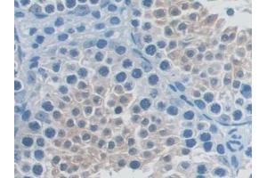 DAB staining on IHC-P; Samples: Mouse Testis Tissue (TNFRSF11A antibody  (AA 359-542))