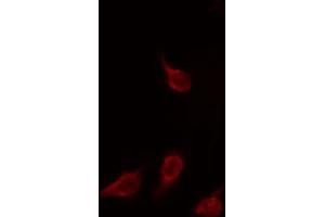 ABIN6266925 staining HuvEc by IF/ICC. (EIF3L antibody  (N-Term))