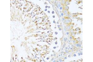 Immunohistochemistry of paraffin-embedded Rat testis using DDX3Y Polyclonal Antibody at dilution of 1:100 (40x lens).