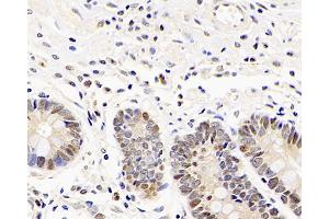 Immunohistochemistry analysis of paraffin-embedded human stomach using Mineralocorticoid receptor Polyclonal Antibody at dilution of 1:300. (NR3C2 antibody)