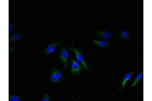 Immunofluorescent analysis of A549 cells using ABIN7161422 at dilution of 1:100 and Alexa Fluor 488-congugated AffiniPure Goat Anti-Rabbit IgG(H+L) (NPBWR2 antibody  (AA 1-45))